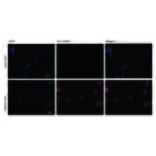Immunocytochemistry - Anti-Histone H3.3 (G34R mutant) Antibody [RM240] (A121313) - Antibodies.com