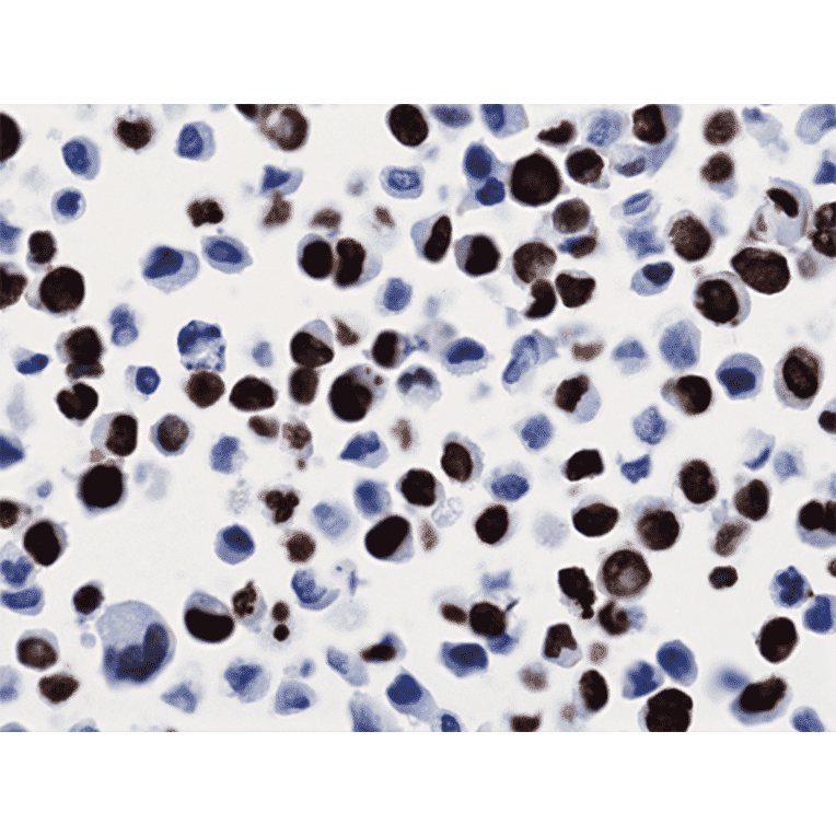 Immunohistochemistry - Anti-Histone H3 (K36M mutant) Antibody [RM193] (A121200) - Antibodies.com