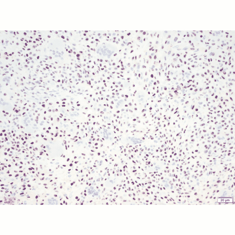 Immunohistochemistry - Anti-Histone H3 (K36M mutant) Antibody [RM193] (A121297) - Antibodies.com