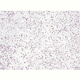 Immunohistochemistry - Anti-Histone H3 (K36M mutant) Antibody [RM193] (A121297) - Antibodies.com