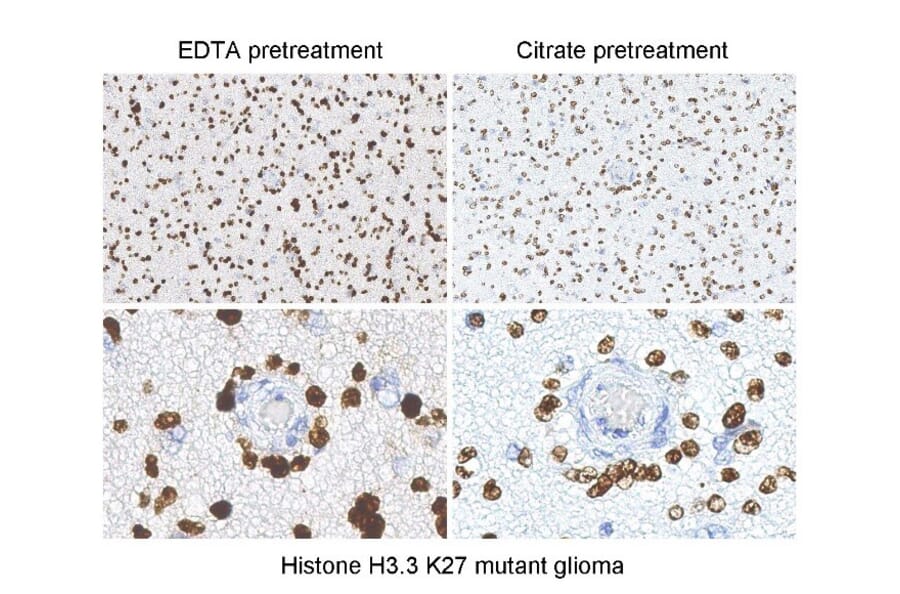 Immunohistochemistry - Anti-Histone H3 (K27M mutant) Antibody [RM192] (A121298) - Antibodies.com