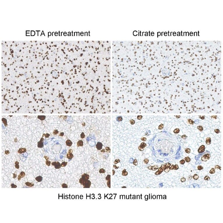 Immunohistochemistry - Anti-Histone H3 (K27M mutant) Antibody [RM192] (A121298) - Antibodies.com