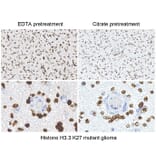 Immunohistochemistry - Anti-Histone H3 (K27M mutant) Antibody [RM192] (A121298) - Antibodies.com