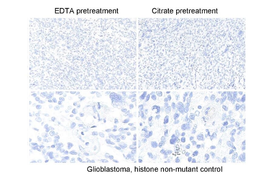 Immunohistochemistry - Anti-Histone H3 (K27M mutant) Antibody [RM192] (A121298) - Antibodies.com