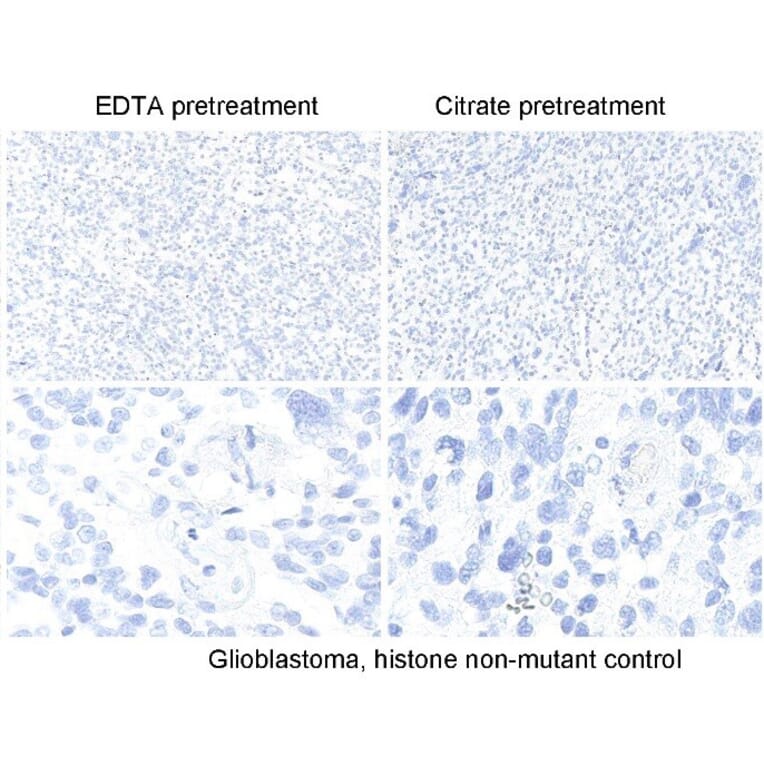 Immunohistochemistry - Anti-Histone H3 (K27M mutant) Antibody [RM192] (A121298) - Antibodies.com