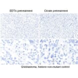 Immunohistochemistry - Anti-Histone H3 (K27M mutant) Antibody [RM192] (A121298) - Antibodies.com