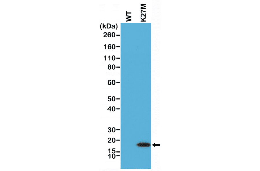 Western Blot - Anti-Histone H3 (K27M mutant) Antibody [RM192] (A121298) - Antibodies.com