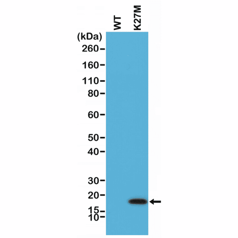 Western Blot - Anti-Histone H3 (K27M mutant) Antibody [RM192] (A121298) - Antibodies.com