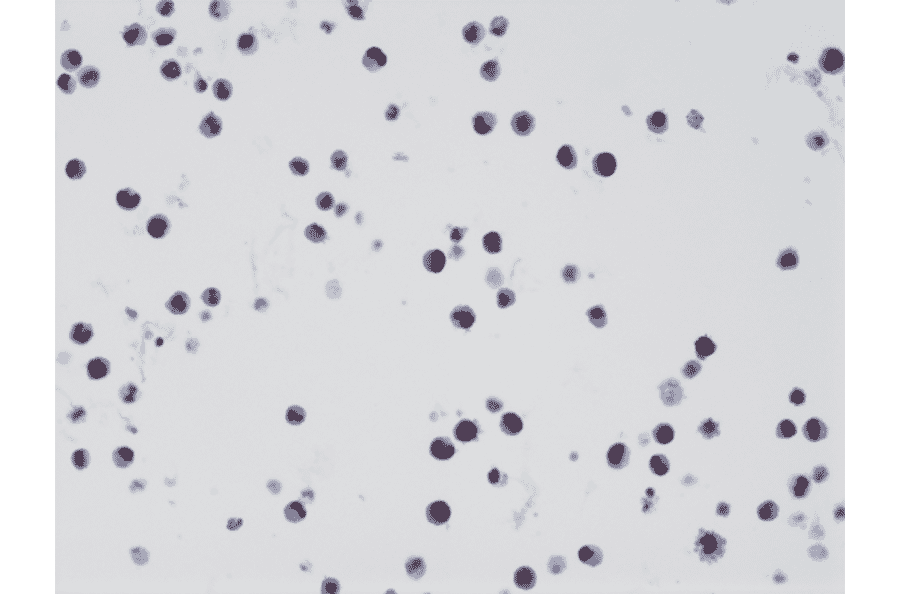 Immunohistochemistry - Anti-Histone H3 (K27M mutant) Antibody [RM192] (A121493) - Antibodies.com