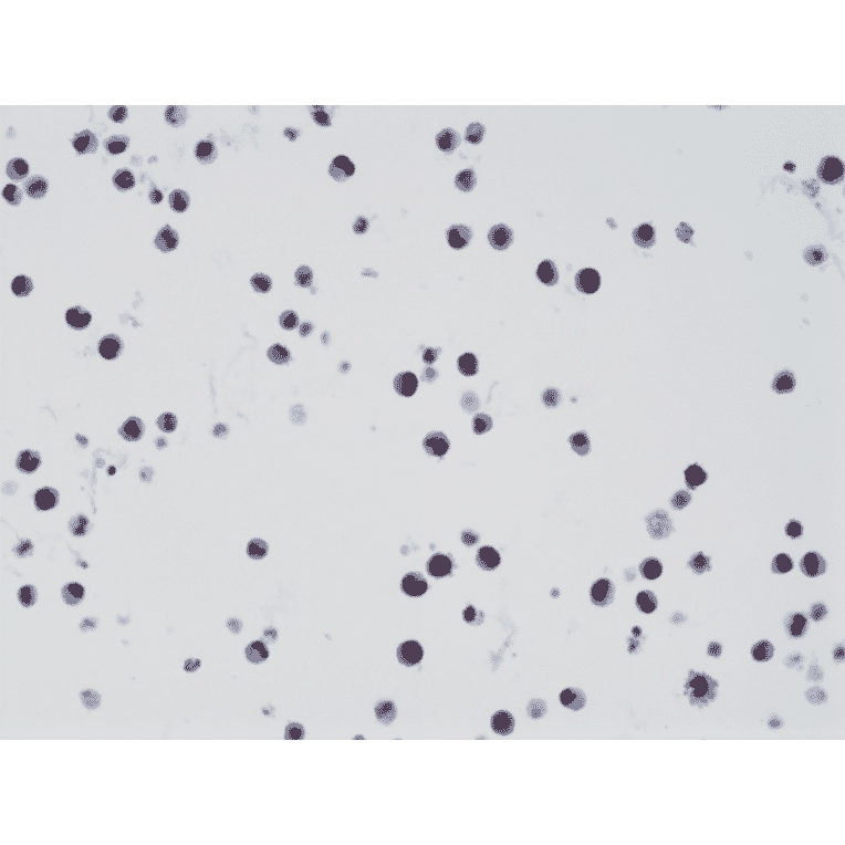 Immunohistochemistry - Anti-Histone H3 (K27M mutant) Antibody [RM192] (A121493) - Antibodies.com