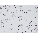 Immunohistochemistry - Anti-Histone H3 (K27M mutant) Antibody [RM192] (A121493) - Antibodies.com