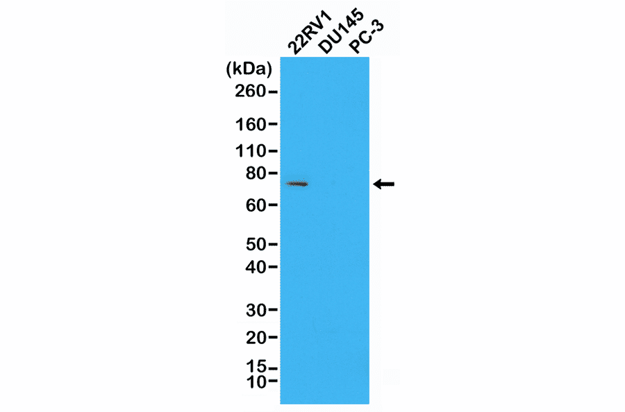 Western Blot - Anti-Androgen Receptor (AR-V7 specific) Antibody [RM7] (A121299) - Antibodies.com