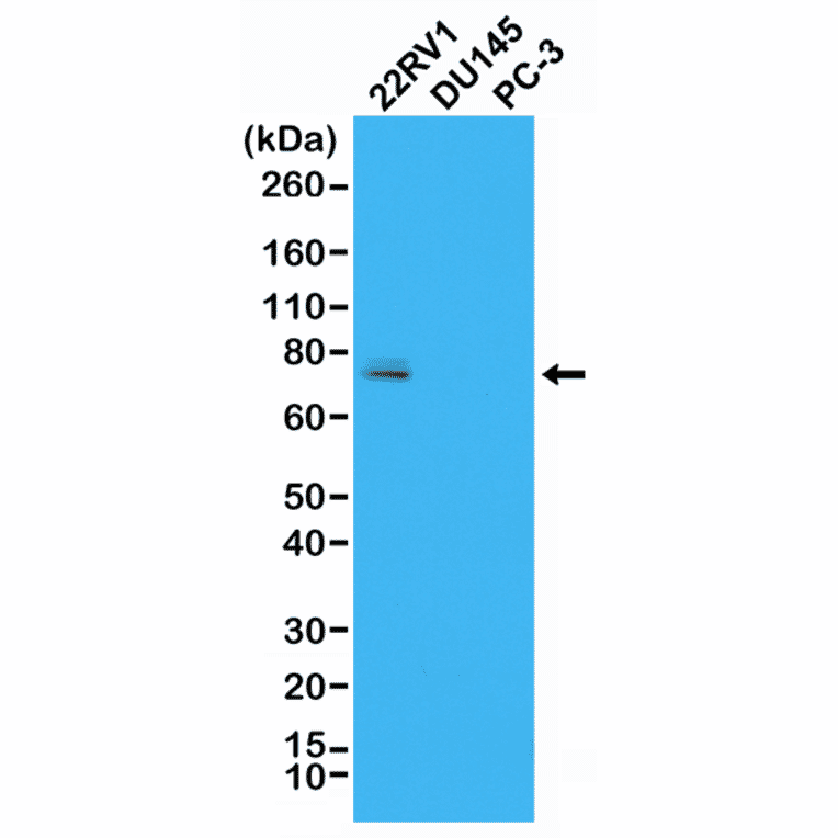 Western Blot - Anti-Androgen Receptor (AR-V7 specific) Antibody [RM7] (A121299) - Antibodies.com