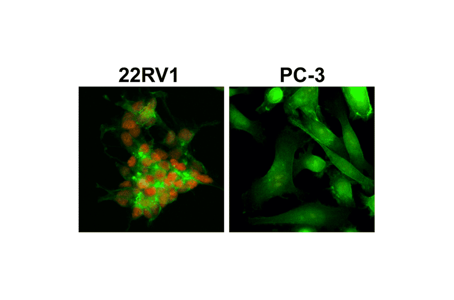 Immunocytochemistry - Anti-Androgen Receptor (AR-V7 specific) Antibody [RM7] (A121316) - Antibodies.com