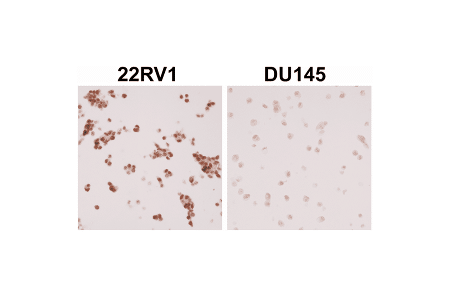 Immunohistochemistry - Anti-Androgen Receptor (AR-V7 specific) Antibody [RM7] (A121299) - Antibodies.com