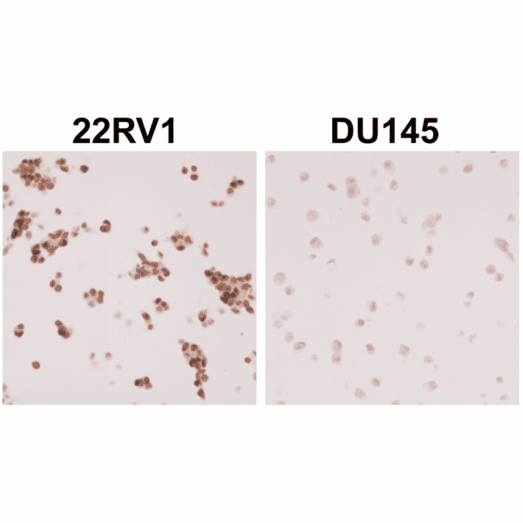 Immunohistochemistry - Anti-Androgen Receptor (AR-V7 specific) Antibody [RM7] (A121299) - Antibodies.com