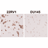 Immunohistochemistry - Anti-Androgen Receptor (AR-V7 specific) Antibody [RM7] (A121299) - Antibodies.com