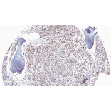 Immunohistochemistry - Anti-Androgen Receptor (AR-V7 specific) Antibody [RM7] (A121299) - Antibodies.com