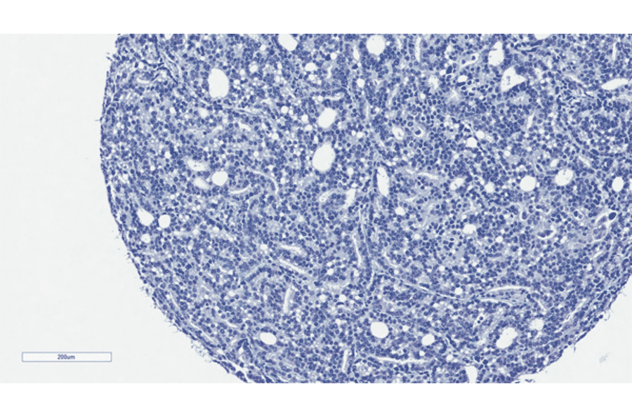 Immunohistochemistry - Anti-Androgen Receptor (AR-V7 specific) Antibody [RM7] (A121299) - Antibodies.com
