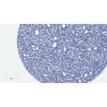 Immunohistochemistry - Anti-Androgen Receptor (AR-V7 specific) Antibody [RM7] (A121299) - Antibodies.com