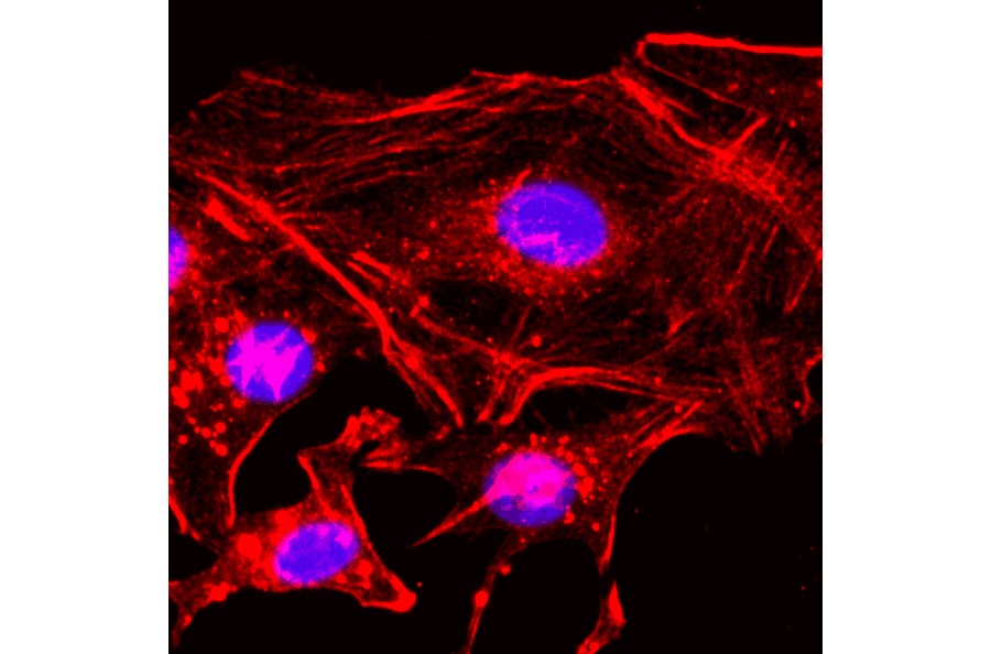 Immunocytochemistry - Anti-beta Actin Antibody (Biotin) [RM112] (A121404) - Antibodies.com