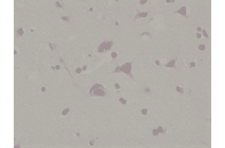 Immunohistochemistry - Anti-Glutamate Receptor 1 (AMPA subtype) (phospho Ser845) Antibody [RM296] (A121406) - Antibodies.com