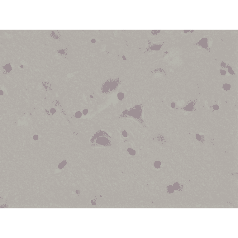 Immunohistochemistry - Anti-Glutamate Receptor 1 (AMPA subtype) (phospho Ser845) Antibody [RM296] (A121406) - Antibodies.com