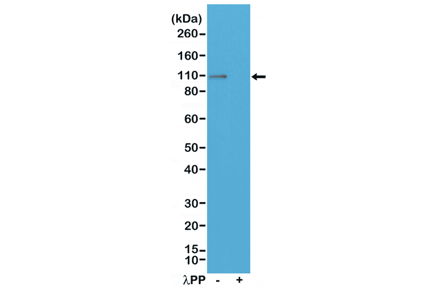 Western Blot - Anti-Glutamate Receptor 1 (AMPA subtype) (phospho Ser845) Antibody [RM296] (A121301) - Antibodies.com