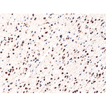 Immunohistochemistry - Anti-IDH1 (R132H mutant) Antibody [RM390] (A121203) - Antibodies.com