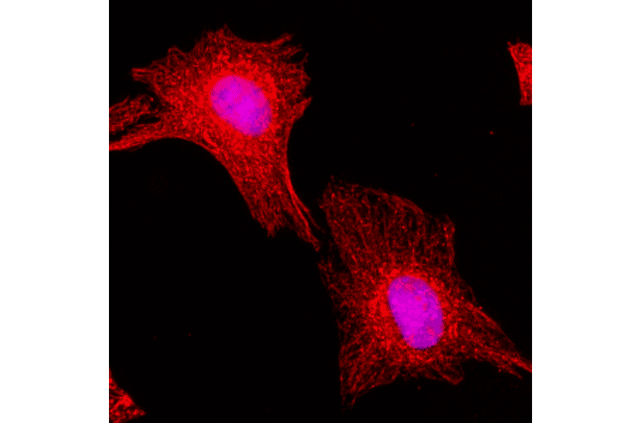 Immunocytochemistry - Anti-alpha Tubulin Antibody (Biotin) [RM113] (A121506) - Antibodies.com