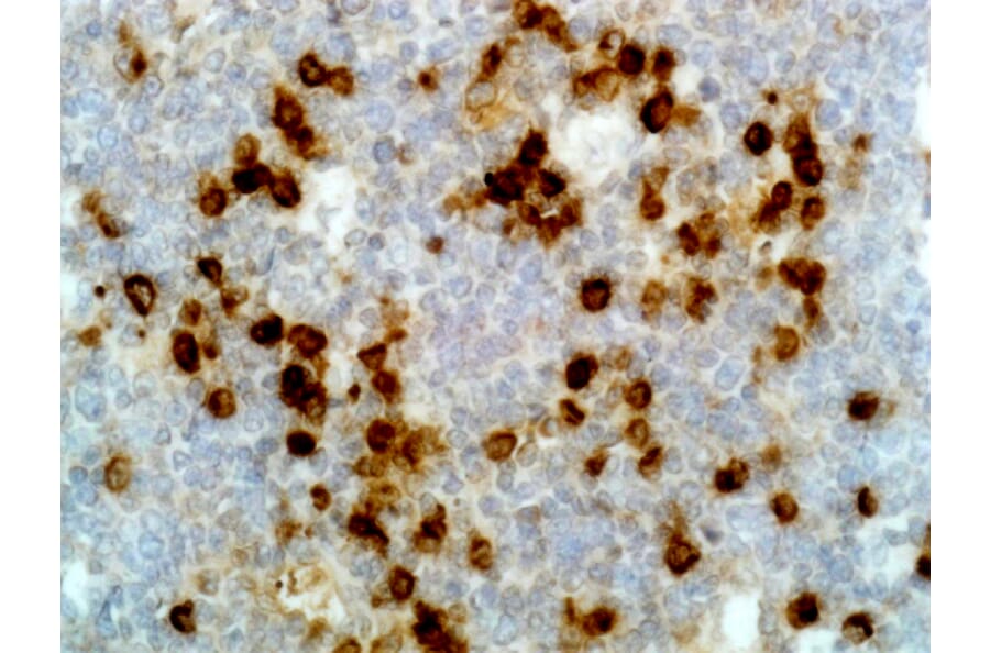 Immunohistochemistry - Anti-Lambda Light Chain Antibody [RM127] (A121310) - Antibodies.com