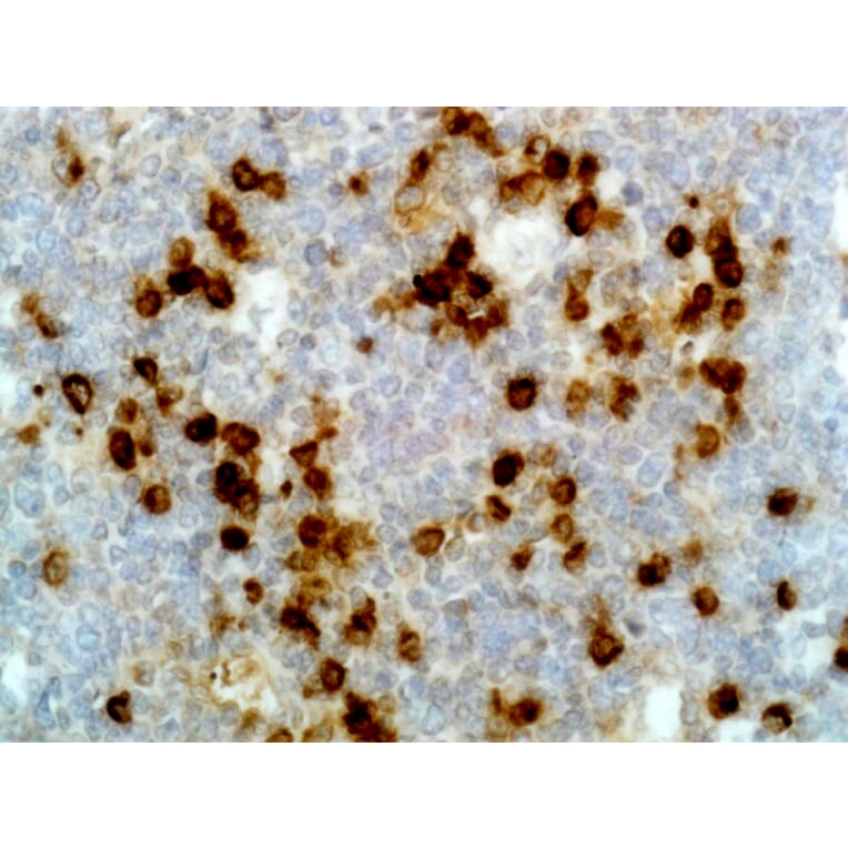 Immunohistochemistry - Anti-Lambda Light Chain Antibody [RM127] (A121310) - Antibodies.com