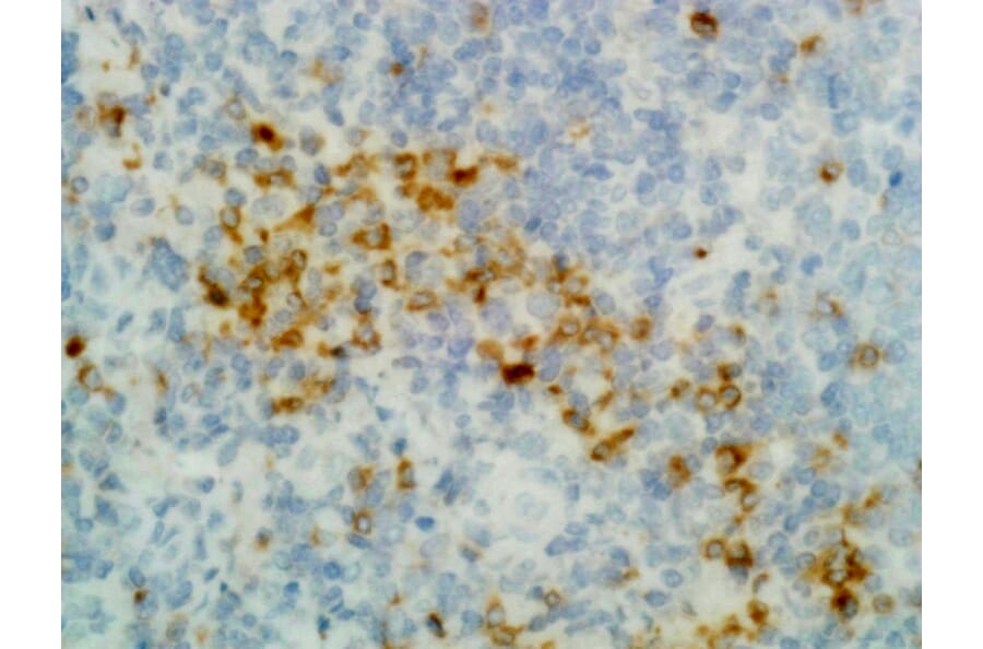 Immunohistochemistry - Anti-gamma Heavy Chain Antibody [RM116] (A121312) - Antibodies.com
