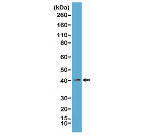Western Blot - Anti-mH2A1 Antibody [RM248] (A121313) - Antibodies.com