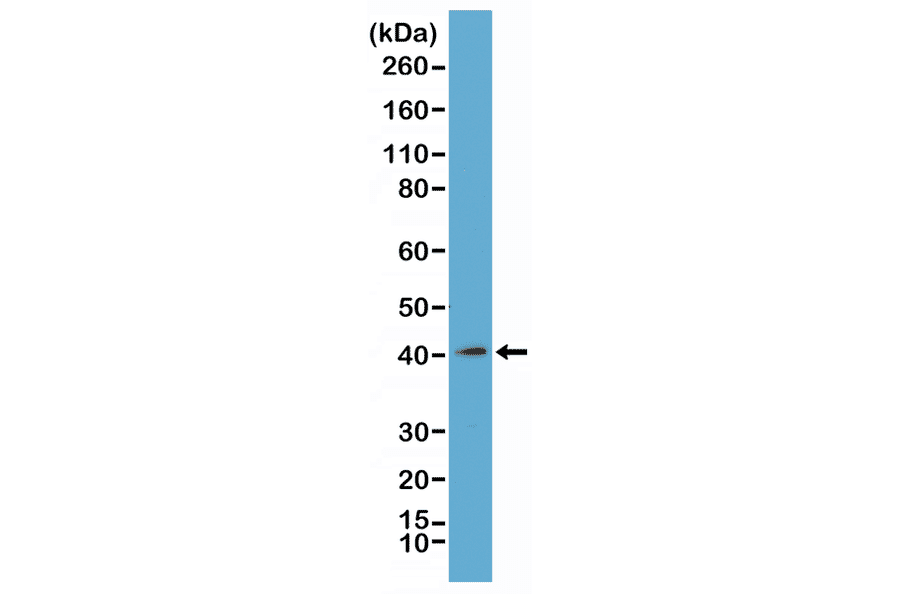 Western Blot - Anti-mH2A1 Antibody [RM248] (A121313) - Antibodies.com