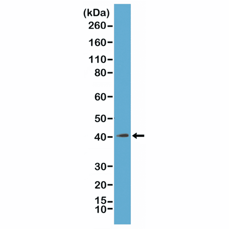 Western Blot - Anti-mH2A1 Antibody [RM248] (A121313) - Antibodies.com