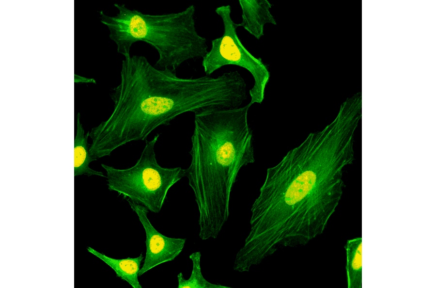 Immunocytochemistry - Anti-mH2A1 Antibody [RM248] (A121193) - Antibodies.com