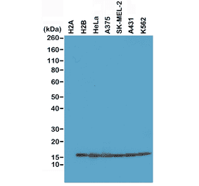 Western Blot - Anti-Histone H2B Antibody [RM230] (A121315) - Antibodies.com