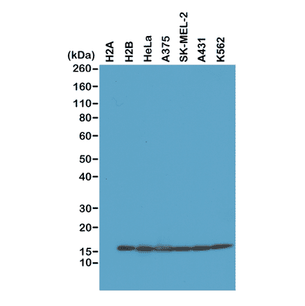 Western Blot - Anti-Histone H2B Antibody [RM230] (A121315) - Antibodies.com