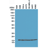 Western Blot - Anti-Histone H2B Antibody [RM230] (A121315) - Antibodies.com