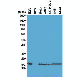 Western Blot - Anti-Histone H2A Antibody [RM225] (A121316) - Antibodies.com