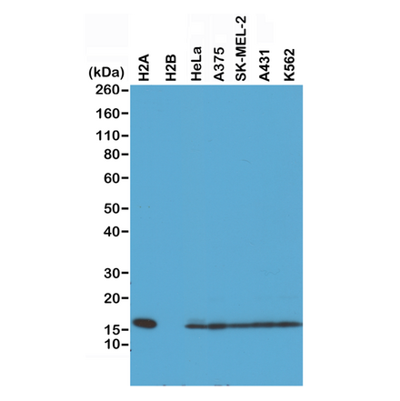 Western Blot - Anti-Histone H2A Antibody [RM225] (A121316) - Antibodies.com