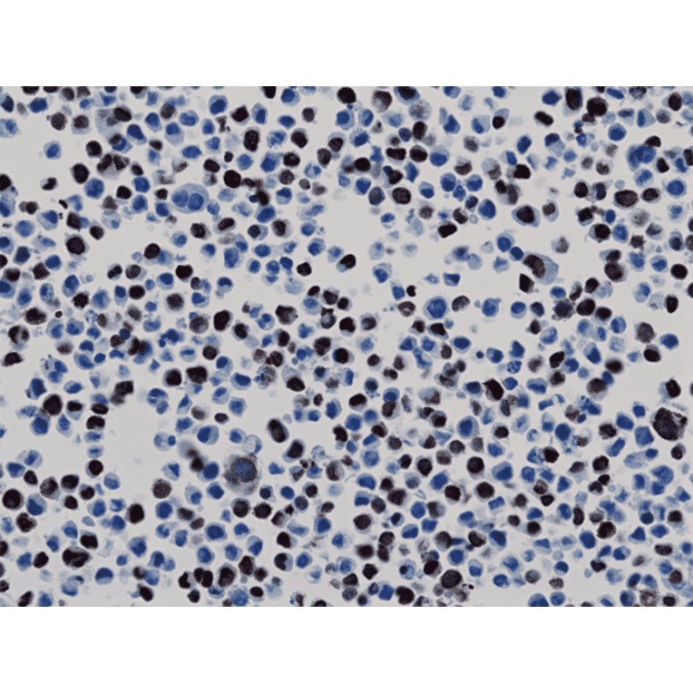 Immunohistochemistry - Anti-His Tag Antibody [RM146] (A121223) - Antibodies.com