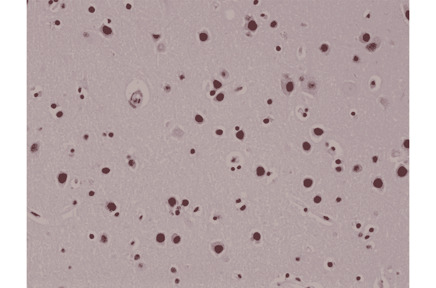 Immunohistochemistry - Anti-5-hydroxymethylcytosine Antibody [RM236] (A121325) - Antibodies.com