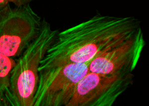 ICC/IF of HeLa cells using Anti-acetylated Lysine Antibody [RM101] (A121327) (red)