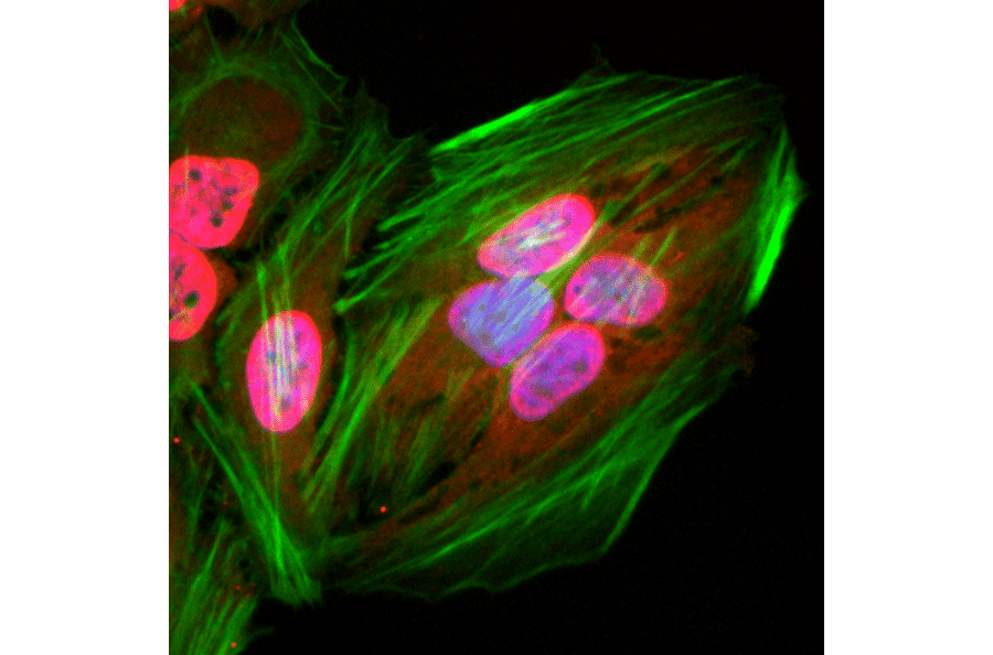 Immunocytochemistry - Anti-acetylated Lysine Antibody [RM101] (A121324) - Antibodies.com