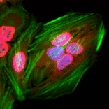 Immunocytochemistry - Anti-acetylated Lysine Antibody [RM101] (A121324) - Antibodies.com