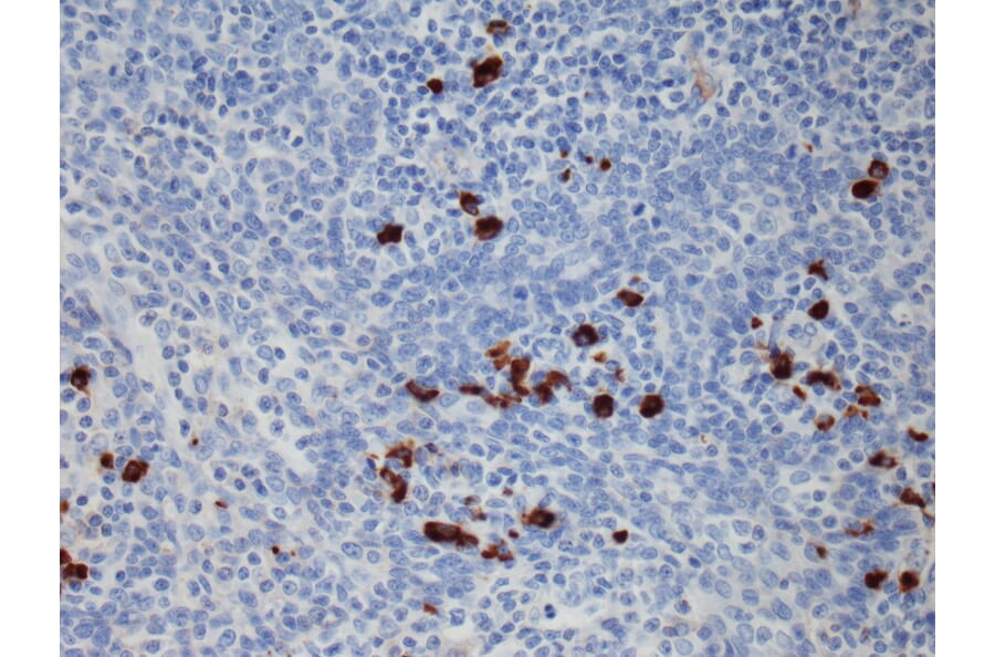 Immunohistochemistry - Anti-Human IgG1 Antibody [RM117] (A121337) - Antibodies.com