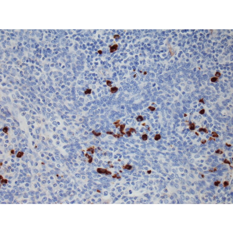 Immunohistochemistry - Anti-Human IgG1 Antibody [RM117] (A121337) - Antibodies.com
