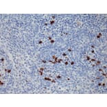 Immunohistochemistry - Anti-Human IgG1 Antibody [RM117] (A121337) - Antibodies.com